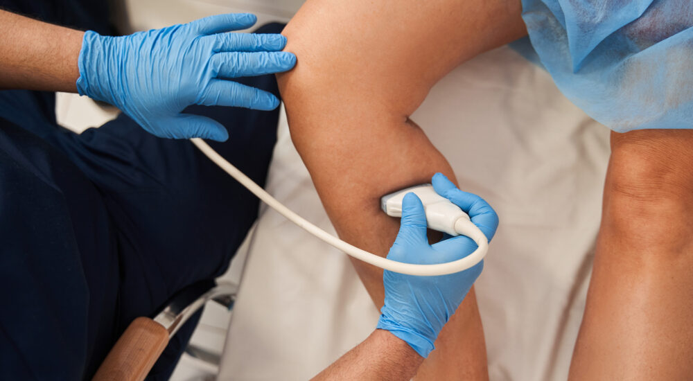 Farbkodierte Duplexsonographie